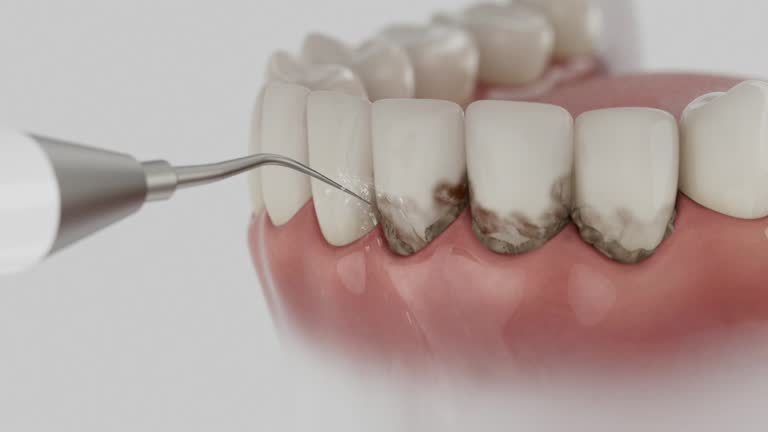 Reliable Teeth Cleaning And Checkup contractor in Scott County County, MS by Dentist Open Now